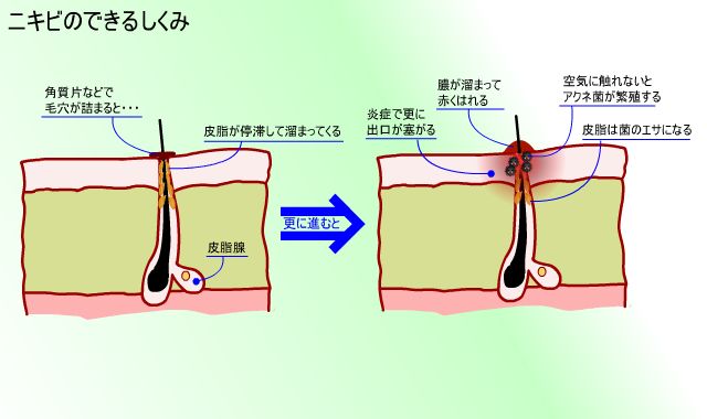 誰もが一度は悩んだことがある！メンズ・レディースに共通するお肌の悩み